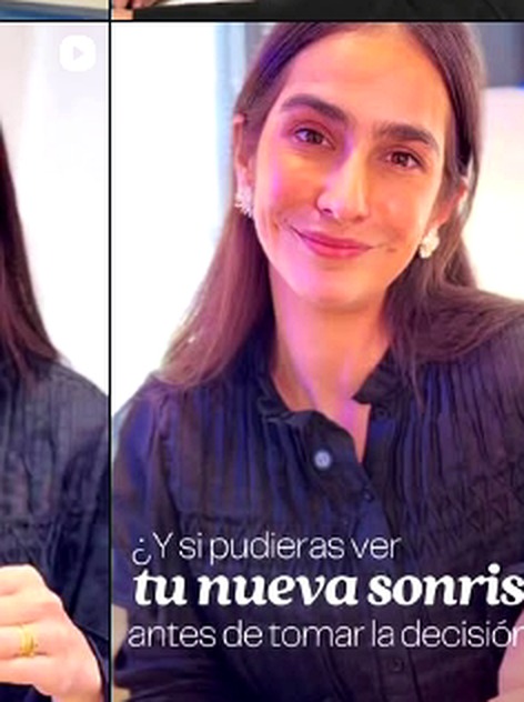 Planificación de sonrisa en Pereda Odontología