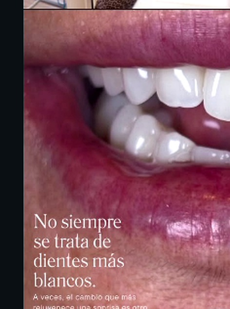 Odontología estética